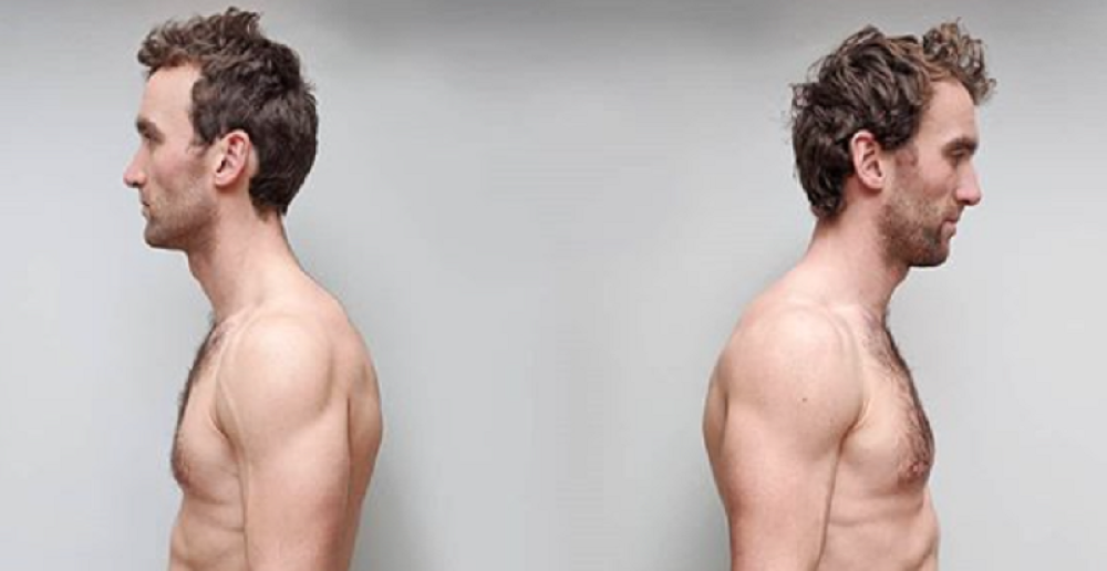 Eksperiment jednojajčanih blizanaca, jedan je bio vegan drugi je jeo meso: Ovo je rezultat!