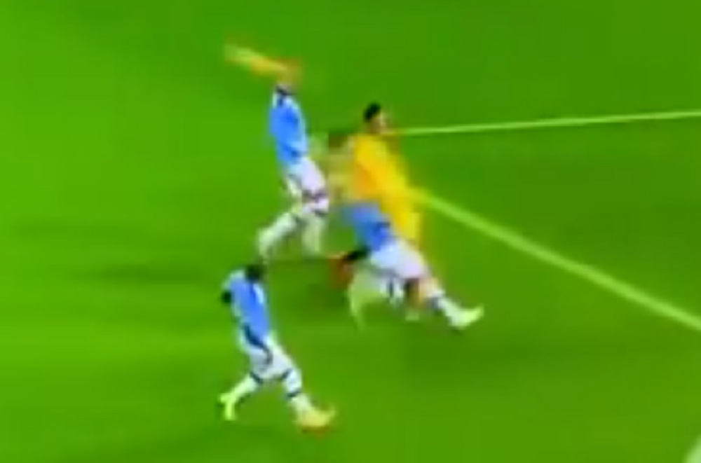 Užasna povreda glave igrača Sitija - ležao nepomično posle sudara sa saigačem (FOTO/VIDEO)