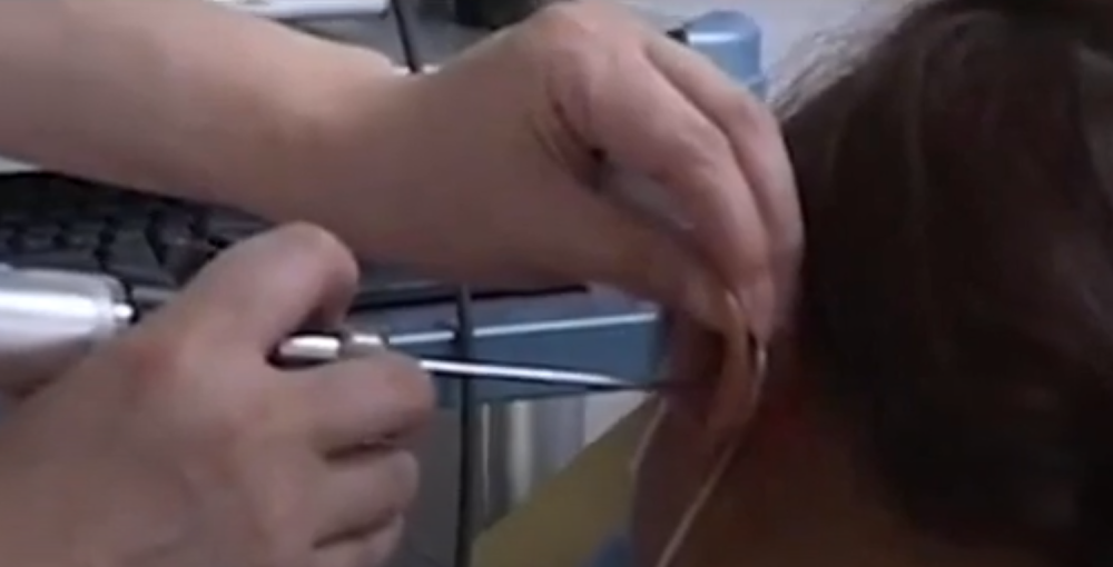 U strašnim bolovima se javila doktoru, a hirurg joj nekoliko minuta kasnije izvadio BUBAŠVABU iz uveta! (UZNEMIRUJUĆI VIDEO)