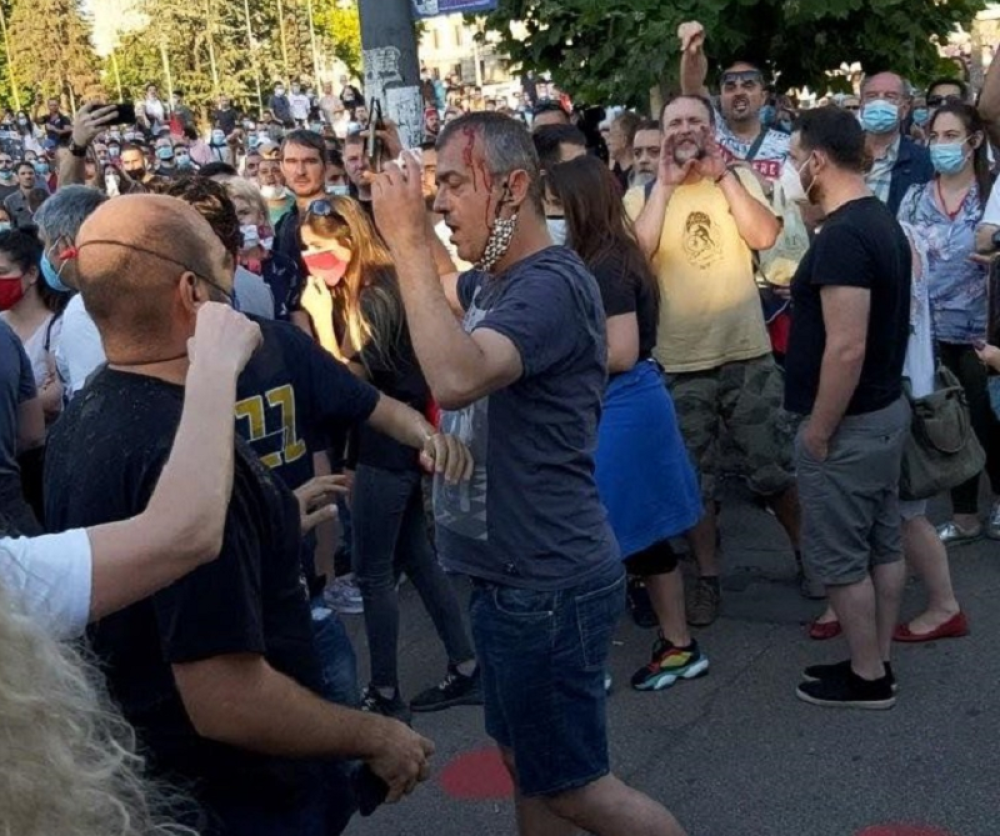 Razbili glavu Sergeju Trifunoviću! (FOTO/VIDEO)