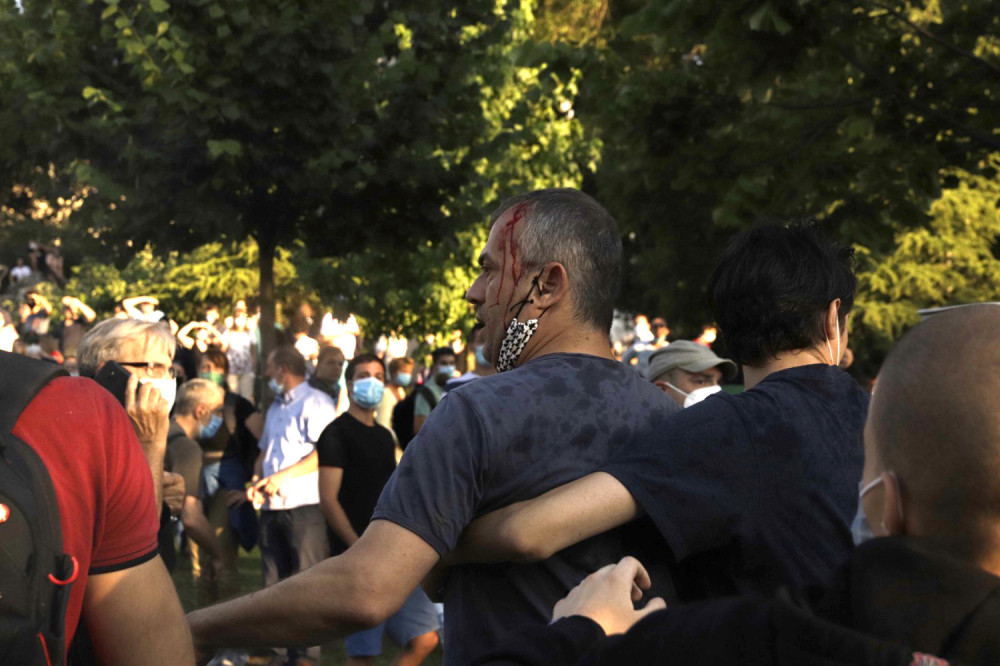 "U gužvi su krenuli da me udaraju sa svih strana"