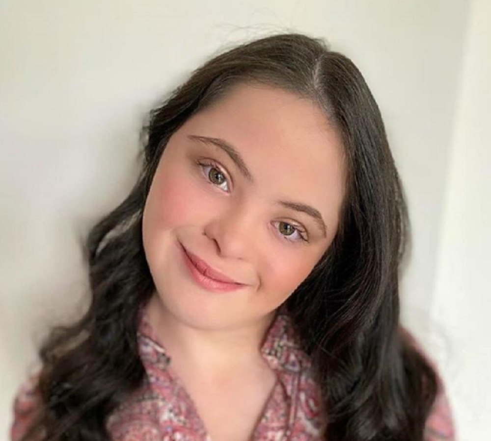 Devojčica sa Daunovim sindromom postala novi "Guči" model, a ovo je njena neverovatna priča!