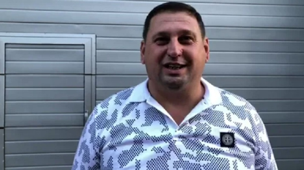 Taki otišao pod nož, evo koji zahvat je radio na licu (VIDEO)