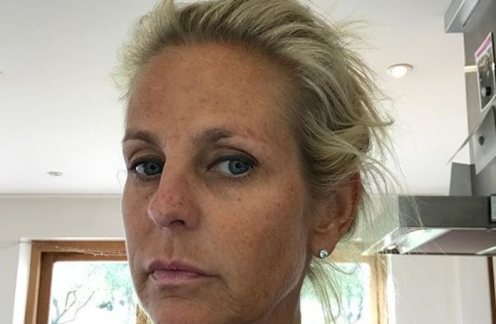 Šveđanka se celog života sunčala bez zaštite, pa objavila jezivi selfi