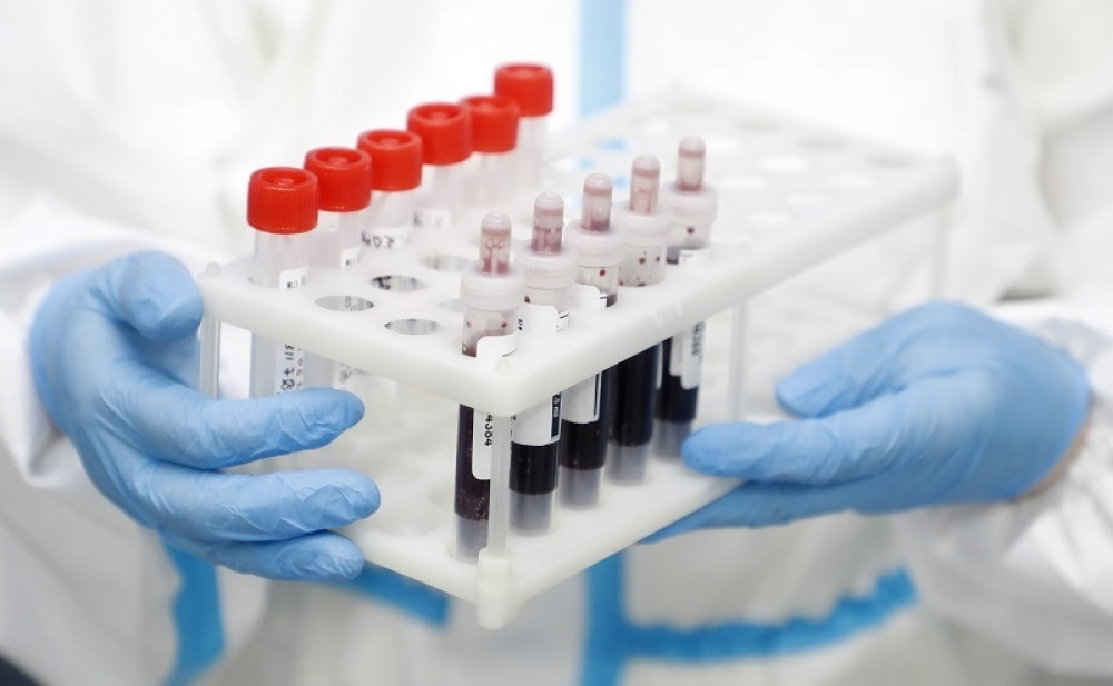 Spremna je prva ruska vakcina protiv koronavirusa!