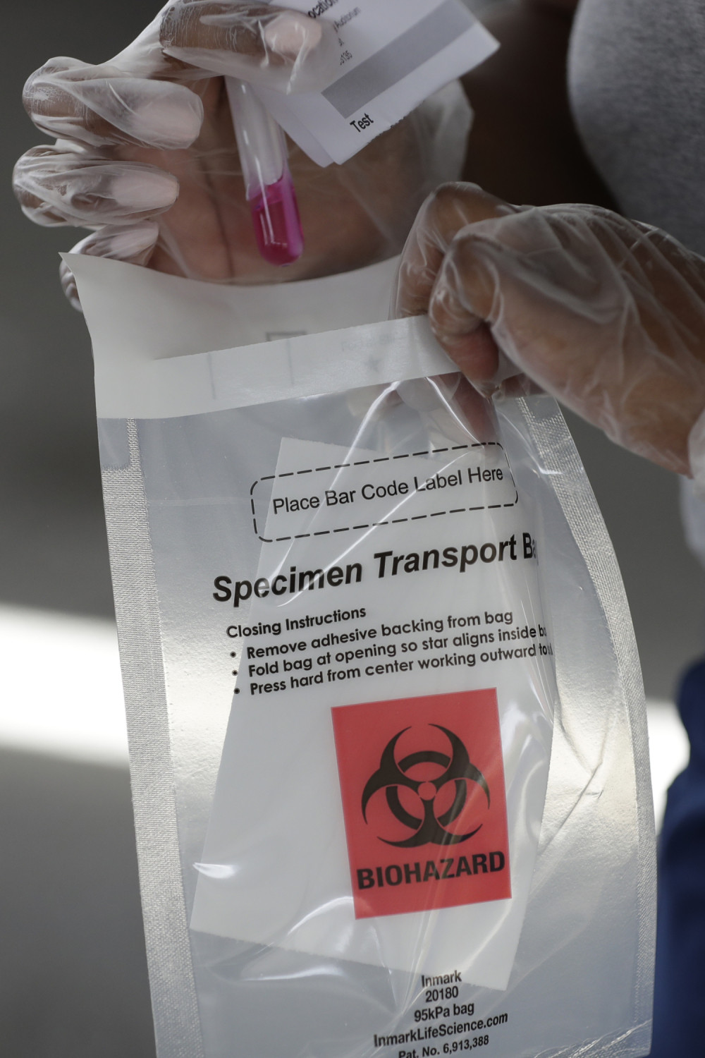 Od njih 94 čak 85 pozitivno na koronu!