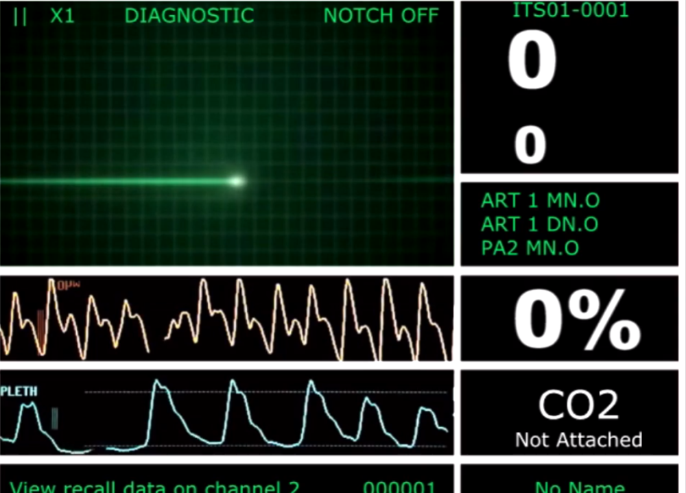 Čovek kad umre, narednih nekoliko sati je svestan svega!