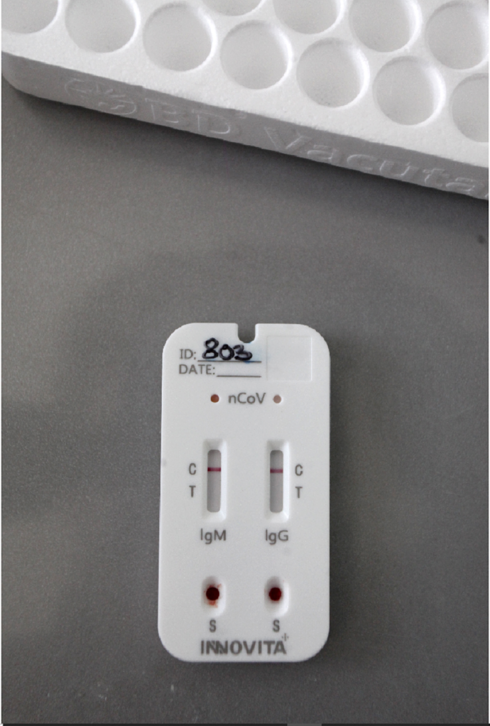 "Osećam blage simptome"