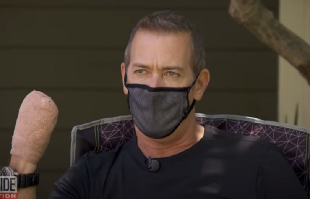 "Više nemam prste, ovo može i vama da se desi"