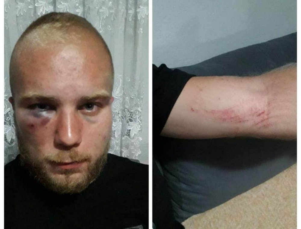 Uz psovanje "srpske majke", Jočića tukli Edin, Aldin, Hivza, Belmin i Asmir!