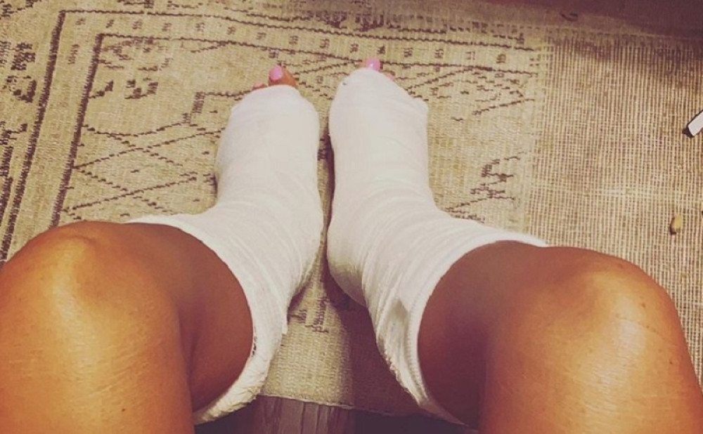 Starleta polomila oba stopala na odmoru: Posledice će biti strašne (FOTO)