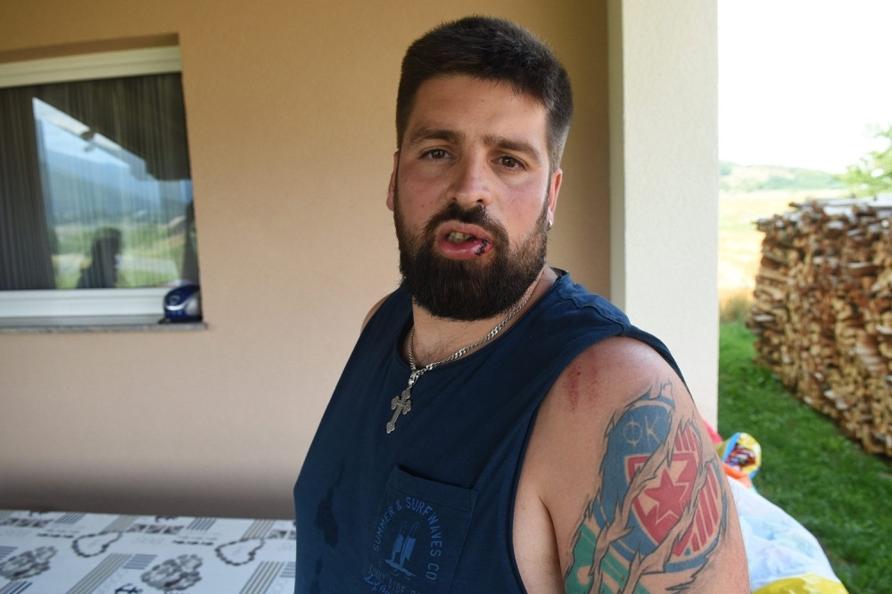 Ovo je Saša Vukojević, Srbin koji je dobio strašne batine u Hrvatskoj! (UZNEMIRUJUĆI SADRŽAJ)