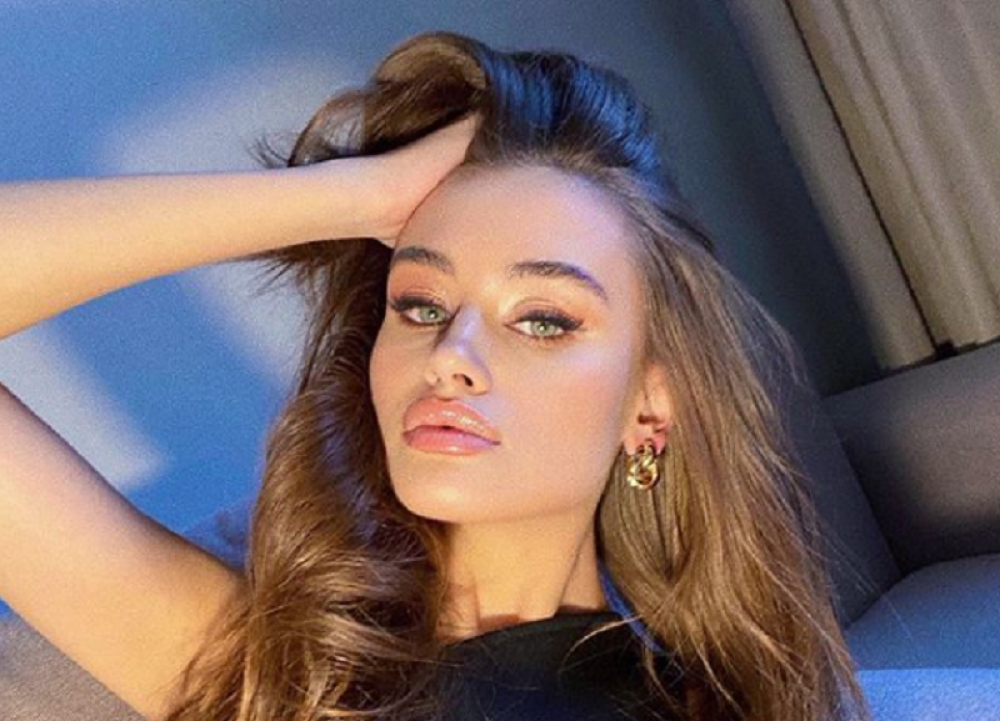 Brutalno pretučena: Manekenka objavila fotografije potpuno unakaženog lica (FOTO)