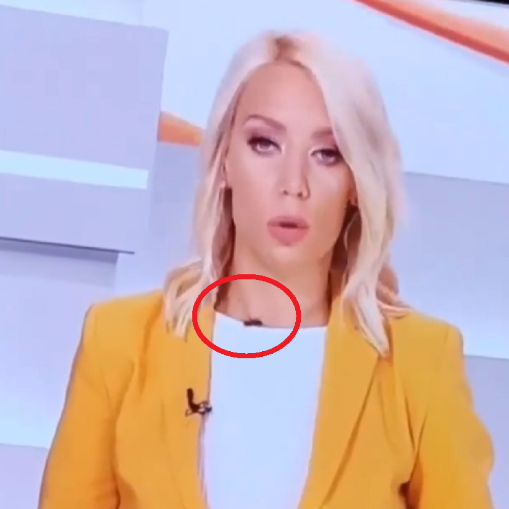 Ogromna buba joj šeta po vratu dok ona vodi program uživo: Voditeljka sve iznenadila reakcijom! (FOTO)