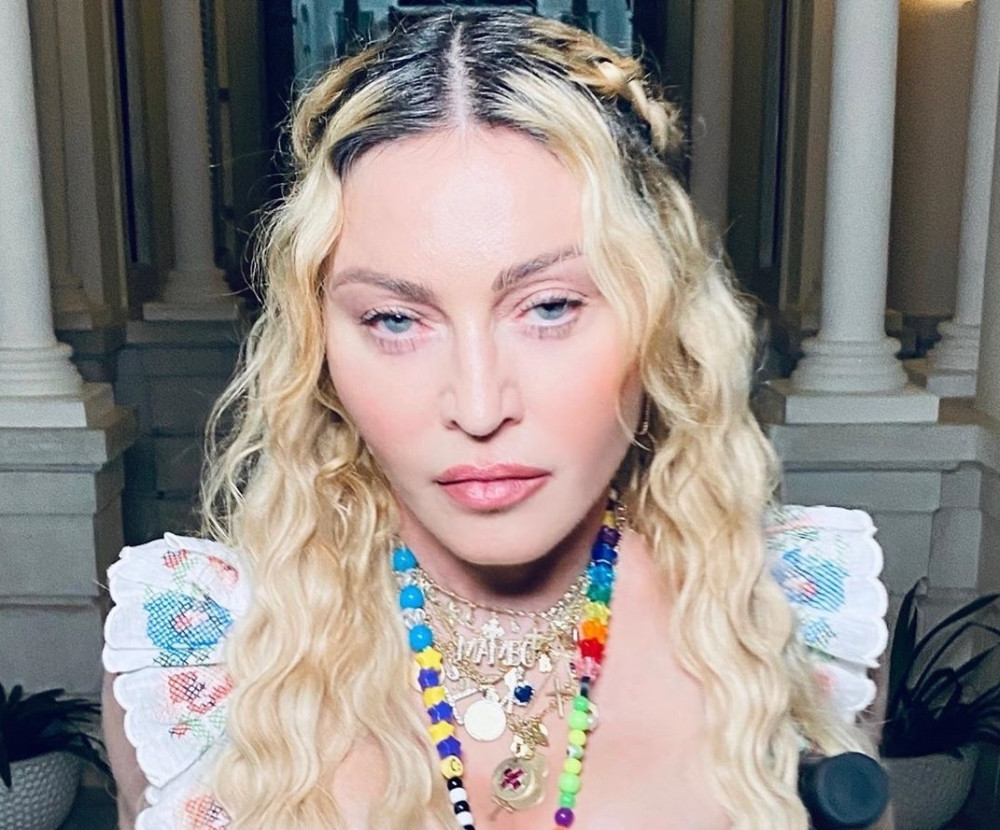 Madona za 62. rođendan, na štakama,  goste služila DROGOM, alkoholom, a njen izgled sablaznio je sve!  (FOTO)