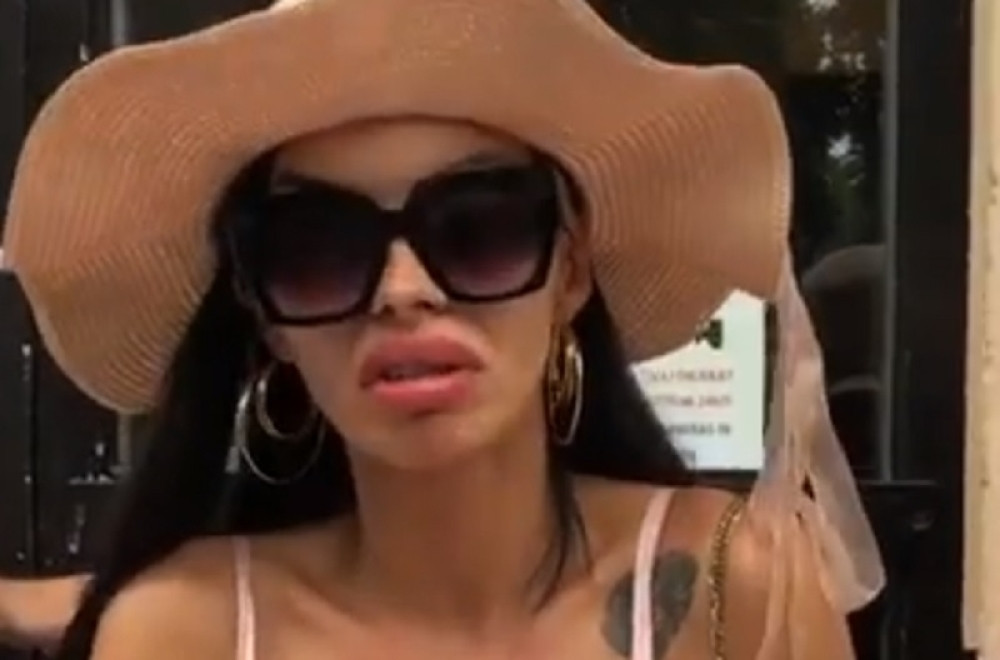 Zerina Hećo pred našim kamerama pokazala modrice i progovorila o traumi! (VIDEO)