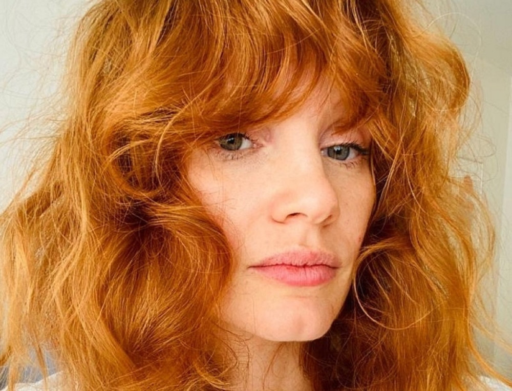 Slavnoj glumici celo lice unakaženo i u krvi, zastrašujući prizor uplašio sve! (FOTO)