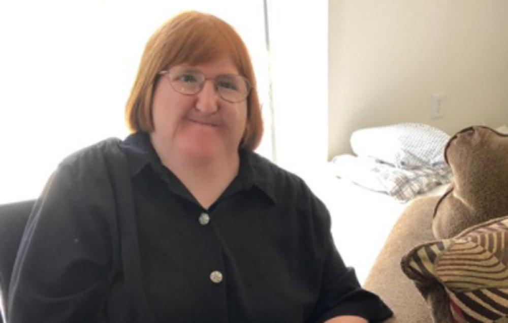 Roditelji u izazovu na društvenoj mreži plaše decu fotografijama bolesnih ljudi! (FOTO/VIDEO)