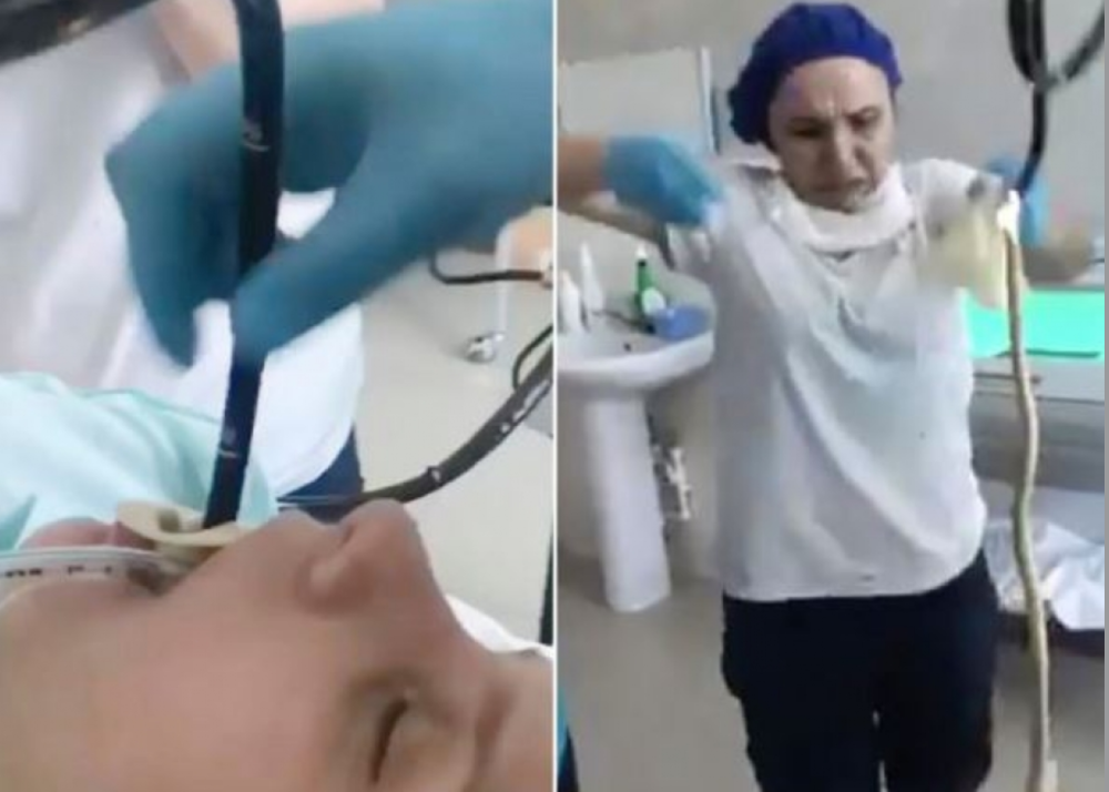 Devojka se požalila na strašne bolove, a kada su stigli u bolnicu, lekari su joj iz grla izvukli zmiju (UZNEMIRUJUĆI VIDEO)