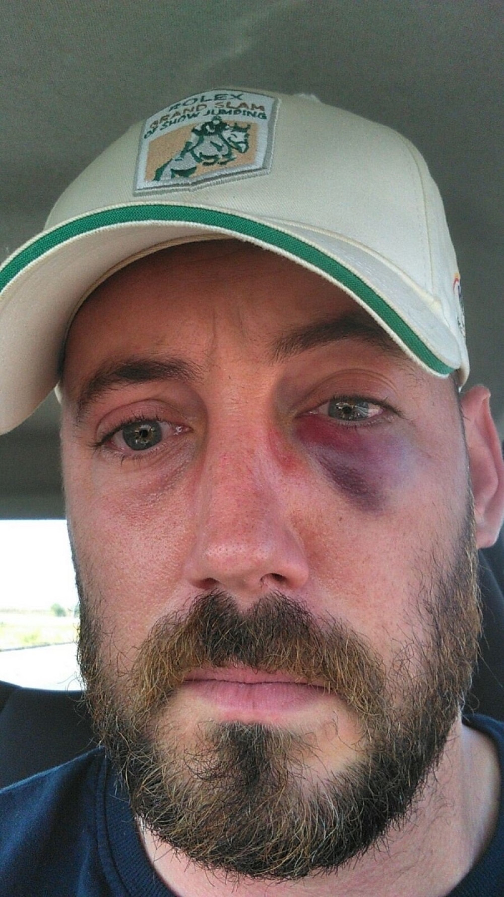 Pretučeni taksista javno progovorio: "Petar Strugar mi polomio vilicu, bio sam u bolnici mesec dana!"