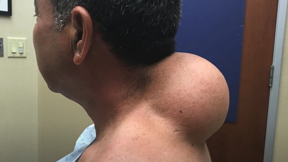 Evo kako je doktorka napravila ČUDO i rešila ga muka! (UZNEMIRUJUĆI VIDEO)