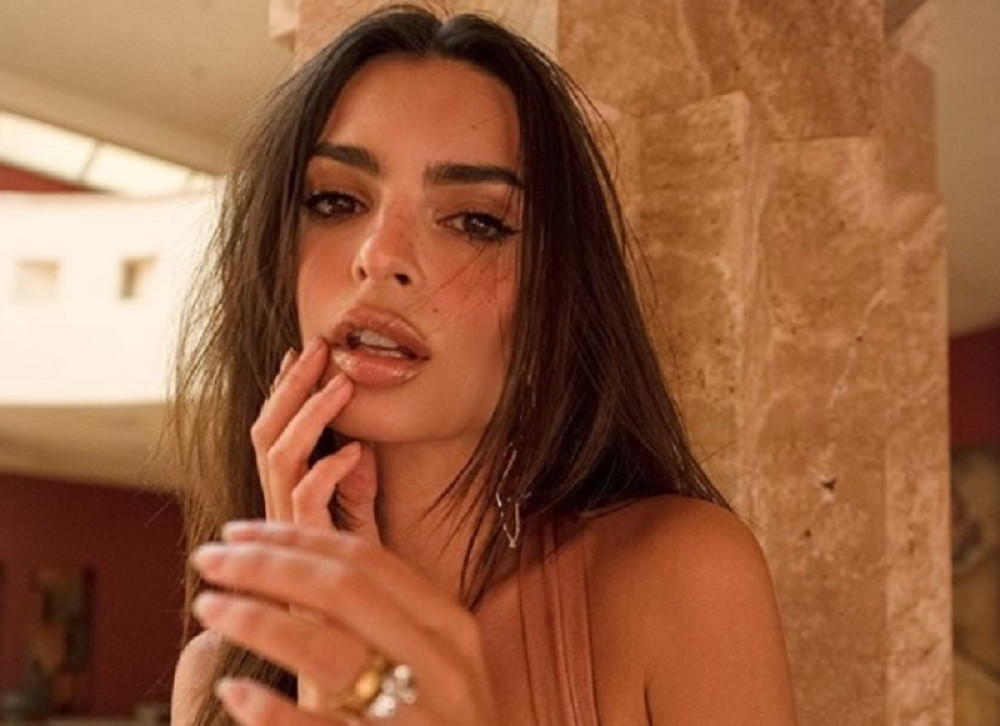 Svetski poznata manekenka optužila fotografa za SILOVANJE! (FOTO)