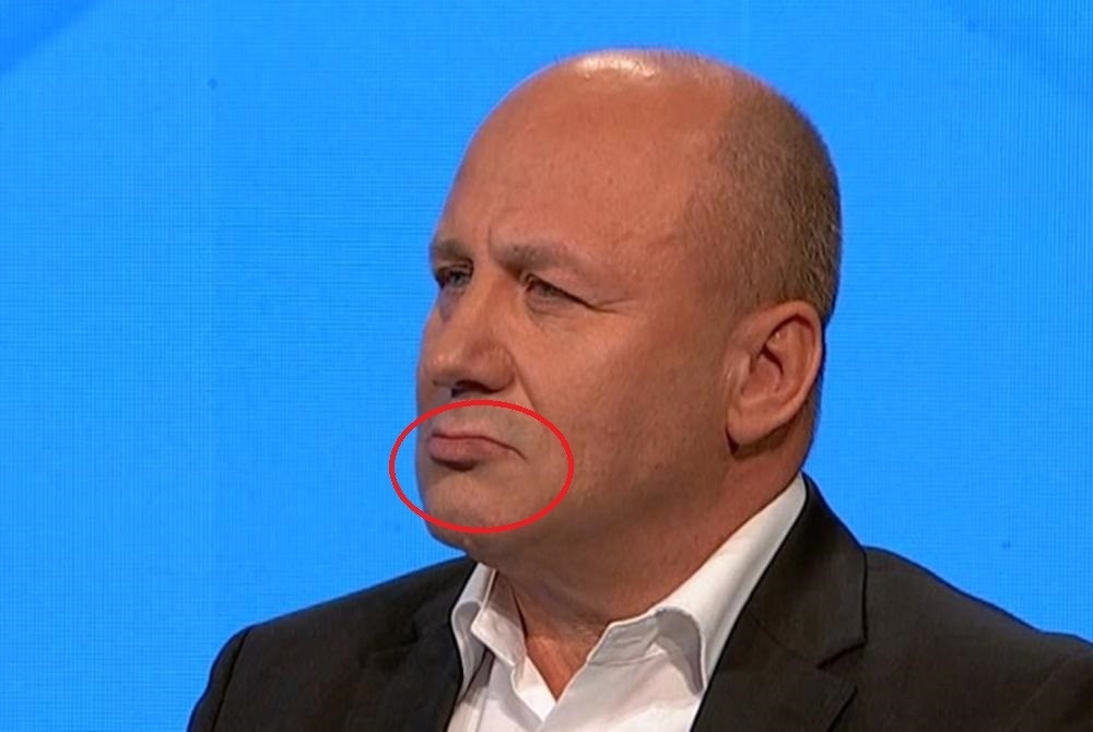 Dragiša Simić uživo priznao da je modrica od pevačice pa oktrio detalje SKANDALA sa Ljupkom Stević!