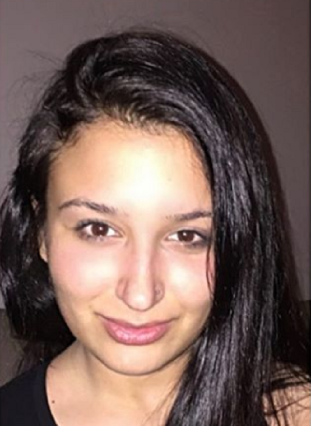 Mulićka je sa 13 godina otišla pod nož, sada ne može da zatvori usta! (FOTO)