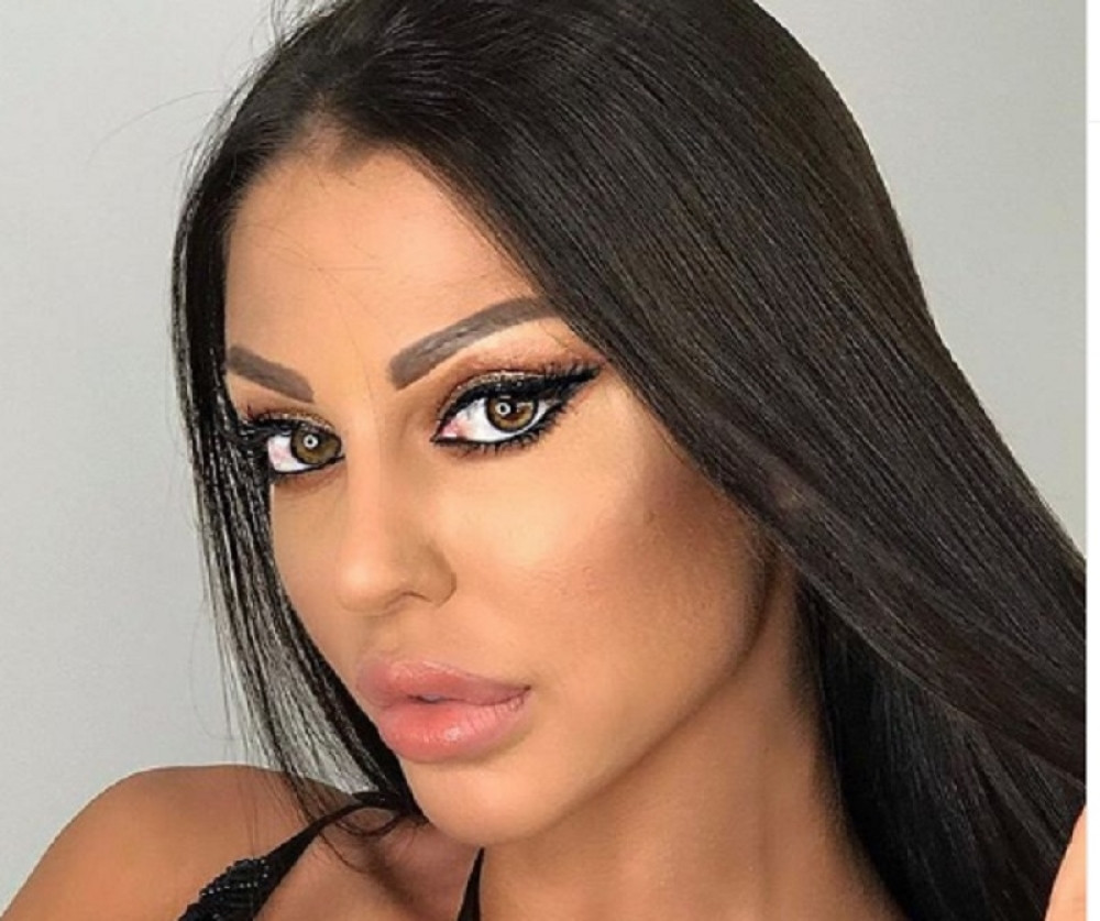 Skoro sve žene sa javne scene imaju "mačije oči": Koncem im vuku kapke, a evo koliko taj estetski zahvat košta!