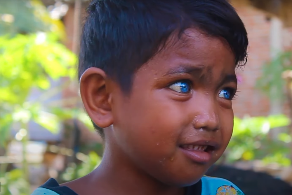 Genetska mutacija i nasledan Vaardenburgov sindrom od ovog plemena je napravio da budu najposebniji ljudi na svetu!  (VIDEO)