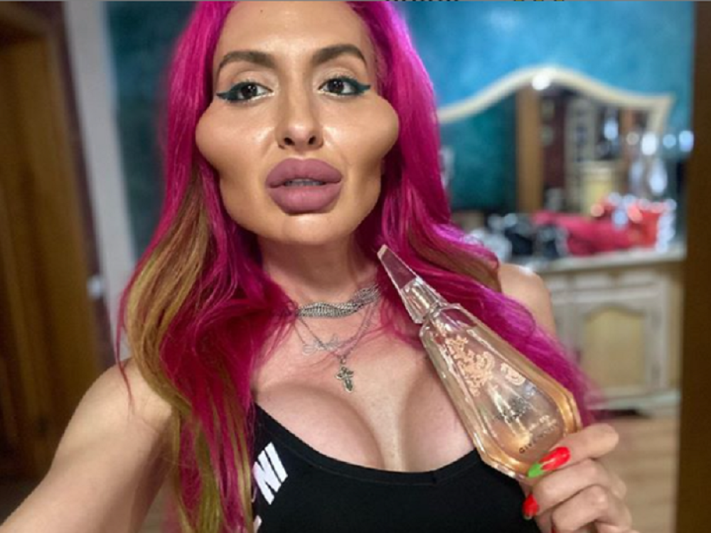 Anastasija ima NAJVEĆE OBRAZE NA SVETU, ali smatra da to nije dovoljno (FOTO)