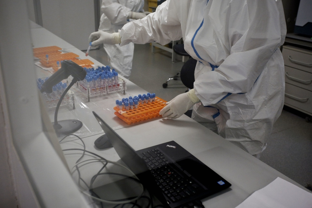 Počeo novi način testiranja na koronu koji će za mnoge biti neugodan