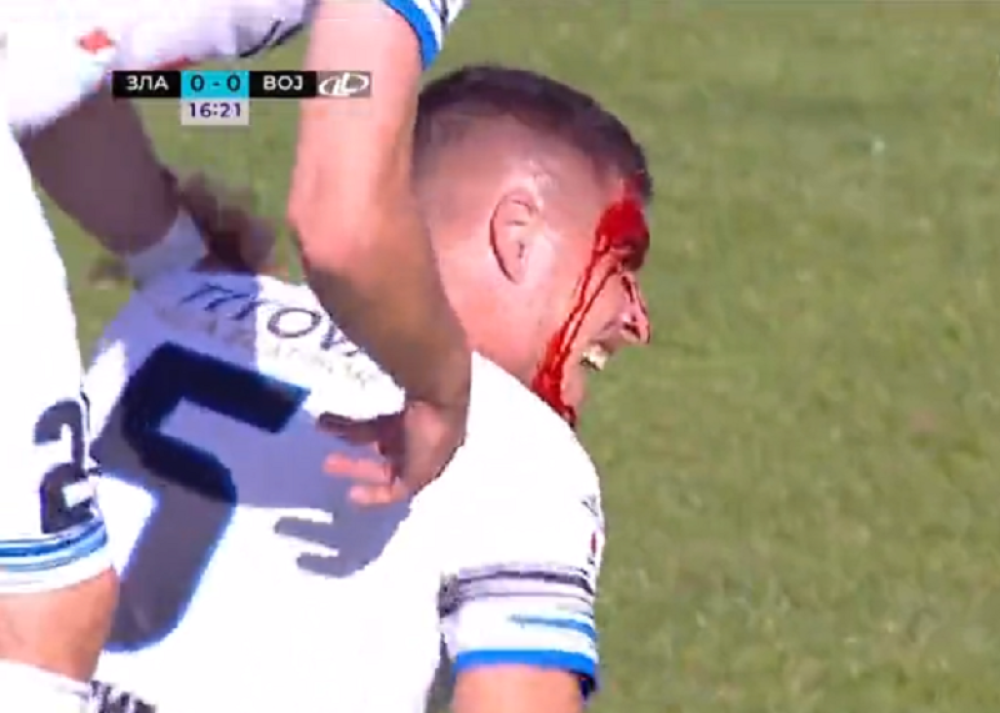 Horor scena u Superligi! Fudbaler Zlatibora krvav napustio teren! (UZNEMIRUJUĆ FOTO)