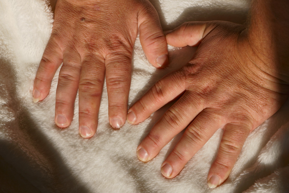 Srpski lekari upozoravaju, to može biti znak opake bolesti