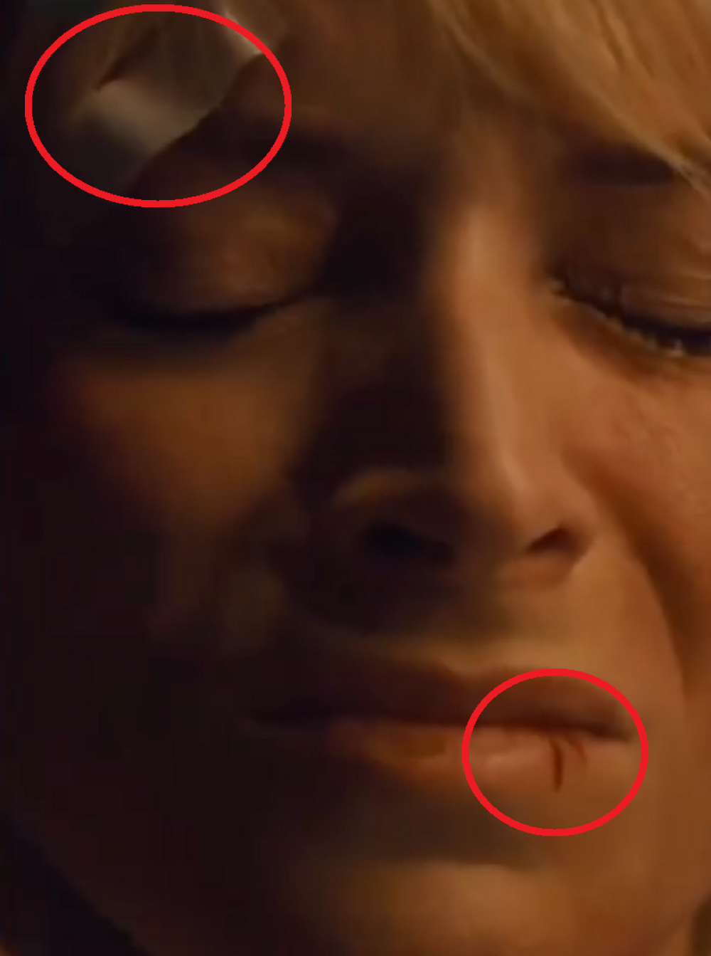 Anđelka Prpić u modricama i zavojima šokirala naciju! (FOTO)