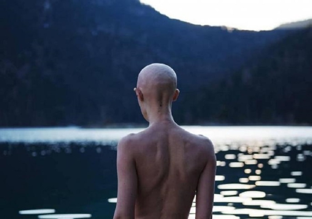 Zbog opake bolesti glumici otpali svi zubi, kosa opala, a ona RADI PUNOM PAROM!