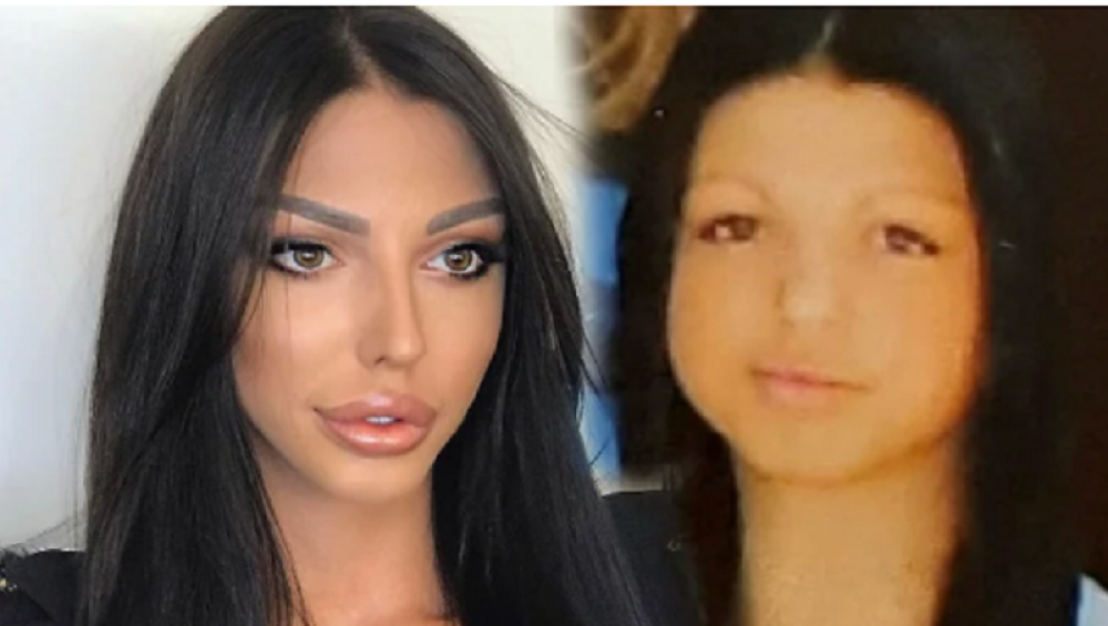 Nećete verovati koliko je para uložila u estetske intervencije! (VIDEO)