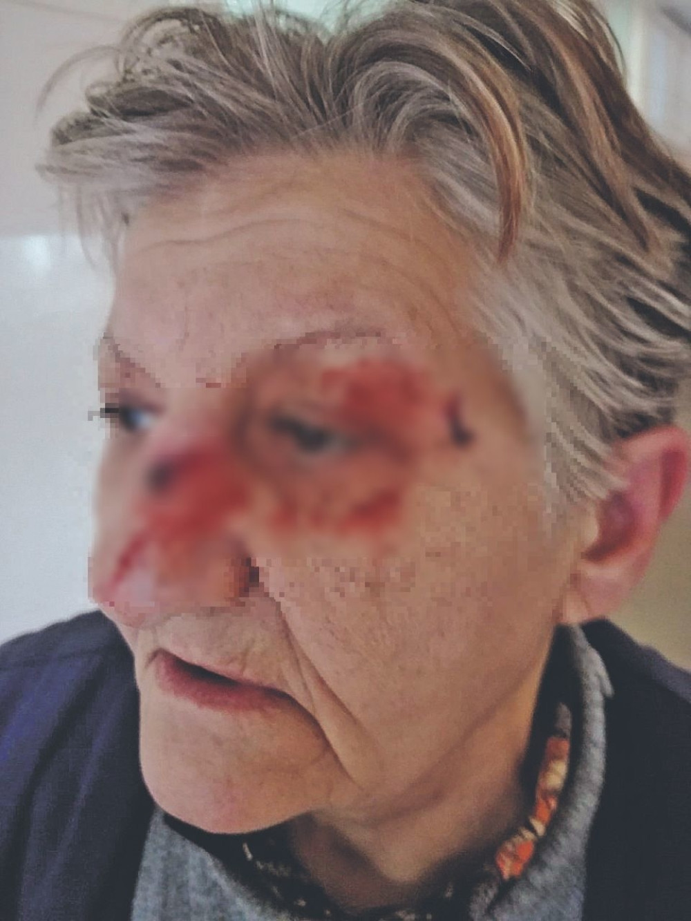 Azra Terzić iz Mladenovca nasrnula na Vericu (65) koja može da joj bude majka: Žena policajca zbog dečje svađe komšinici polomila nos!