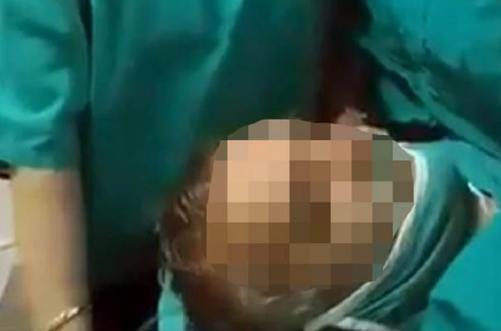 Hirurzi pevaju i tapšu, pacijent na stolu traži RAKIJU, ali nije sve kako izgleda (VIDEO)