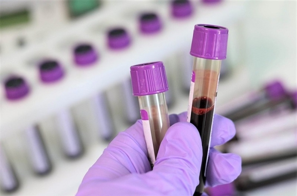 Naučnici otkrili novi lek za koronu!