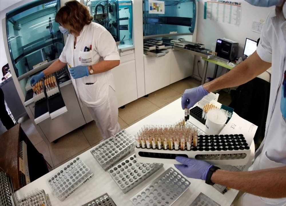 Na Kosovu i Metohiji je aktivno 13.469 slučajeva korona virusa