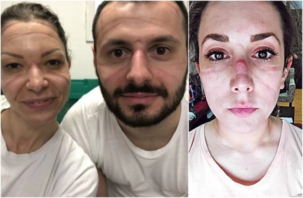 Oboleli od korone, pobedili je pa se vratili nazad na posao da pomognu drugima