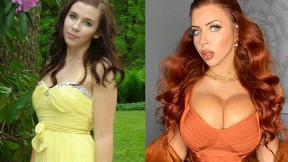 Potrošila je 200 hiljada evra na operacije, a sada zarađuje milione! (FOTO/VIDEO)