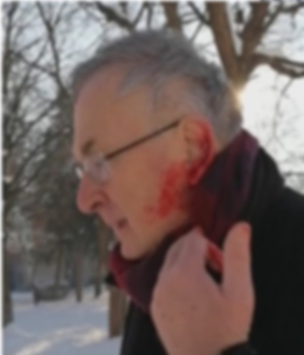 Krvavom čoveku u pomoć pritrčala samo jedna žena