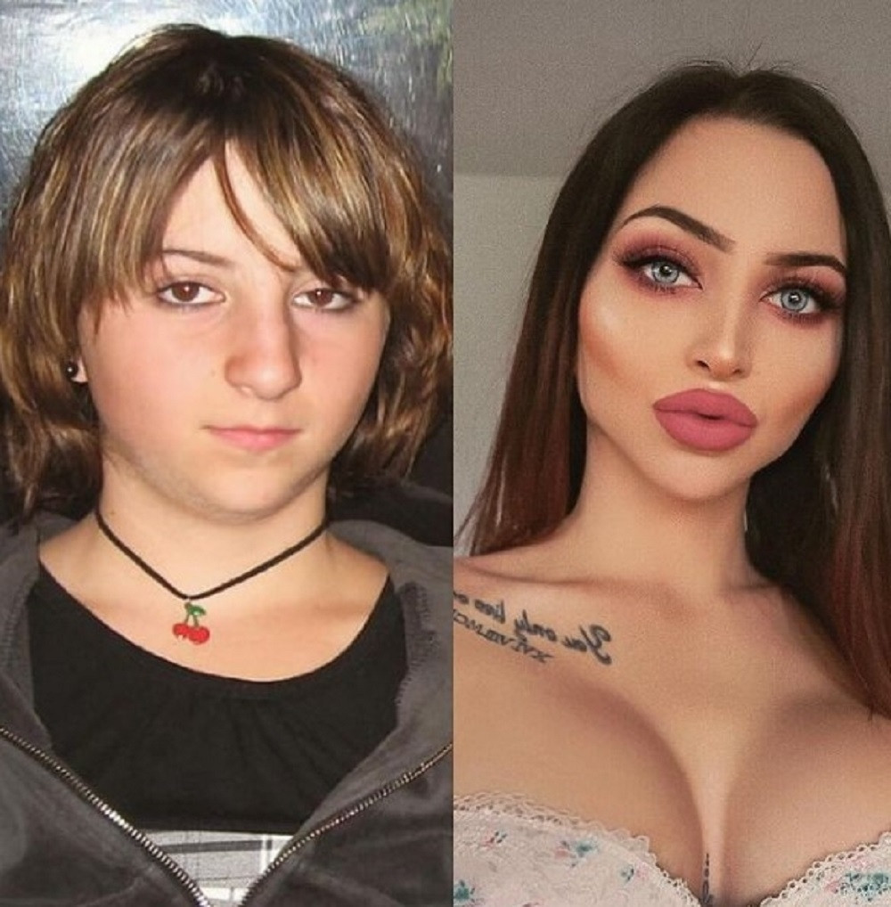 Selin Sentino se promenila plastičnim operacijama i postala bomba! (FOTO/VIDEO)